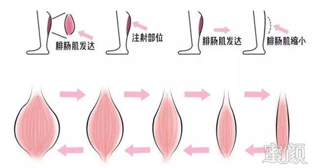 https://img.yiyiaimei.com/mnt/timg/200326/12255G330-2.jpg 案例图片