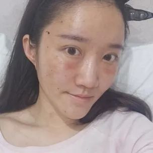 https://img.yiyiaimei.com/mnt/timg/200326/122935EN-1.jpg