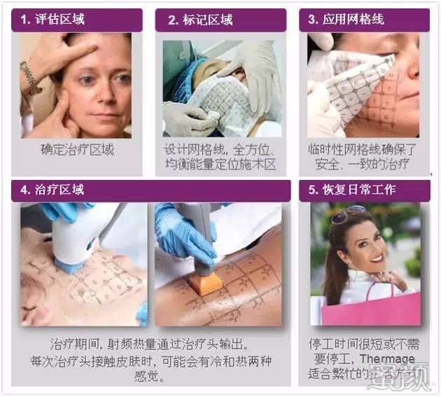 https://img.yiyiaimei.com/mnt/timg/200326/122H12Y9-5.jpg