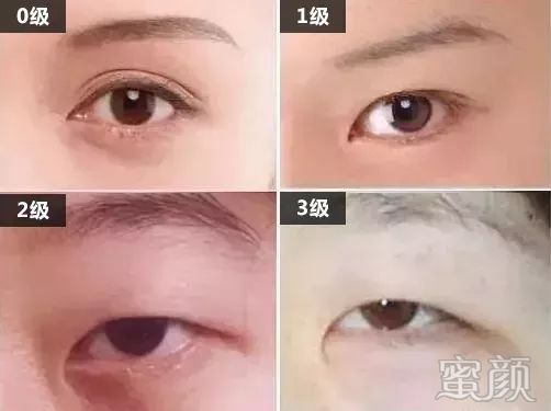 https://img.yiyiaimei.com/mnt/timg/200326/1231351J6-12.jpg