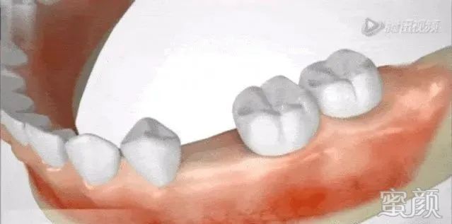 https://img.yiyiaimei.com/mnt/timg/200326/123204IF-2.jpg 案例图片
