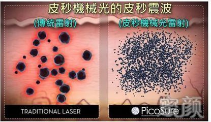 https://img.yiyiaimei.com/mnt/timg/200326/123412K43-6.jpg 案例图片