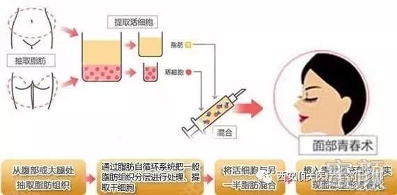 https://img.yiyiaimei.com/mnt/timg/200326/1240314056-3.jpg
