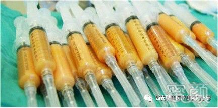 https://img.yiyiaimei.com/mnt/timg/200326/12403335S-5.jpg