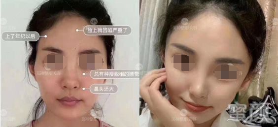 https://img.yiyiaimei.com/mnt/timg/200326/12411G2Q-0.jpg