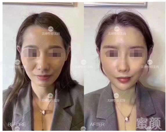 https://img.yiyiaimei.com/mnt/timg/200326/12412110D-3.jpg