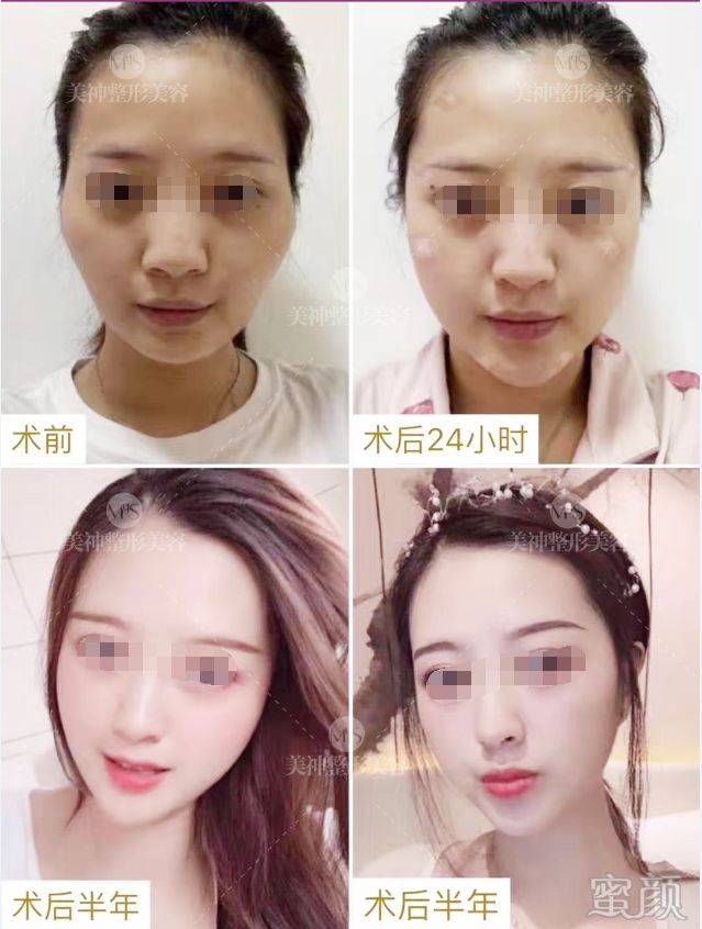 https://img.yiyiaimei.com/mnt/timg/200326/1241245631-5.jpg