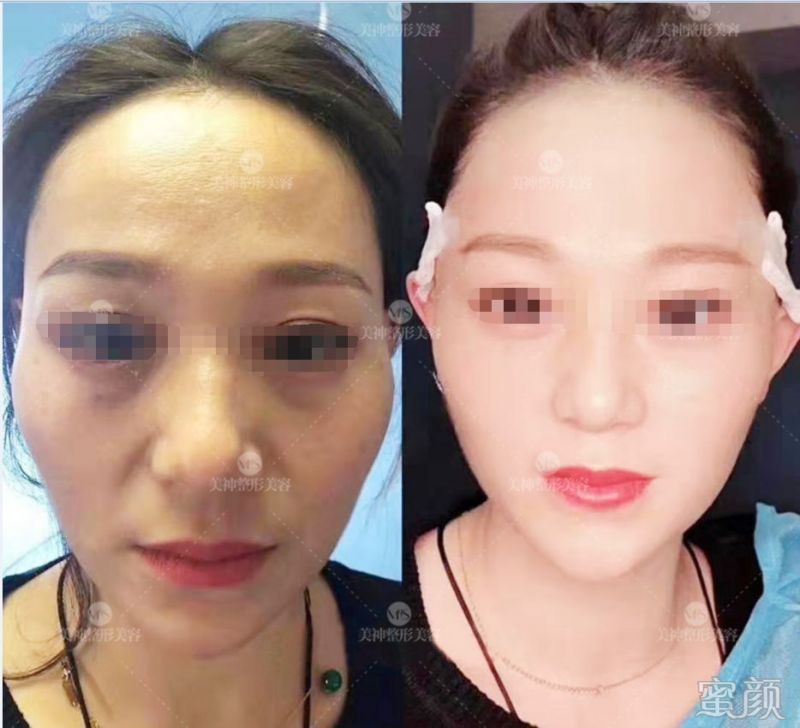 https://img.yiyiaimei.com/mnt/timg/200326/12412B0X-6.jpg