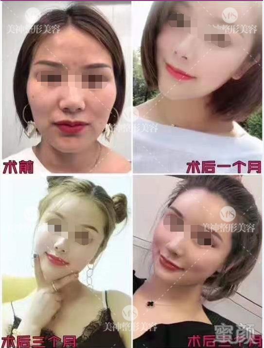 https://img.yiyiaimei.com/mnt/timg/200326/12412V4N-7.jpg
