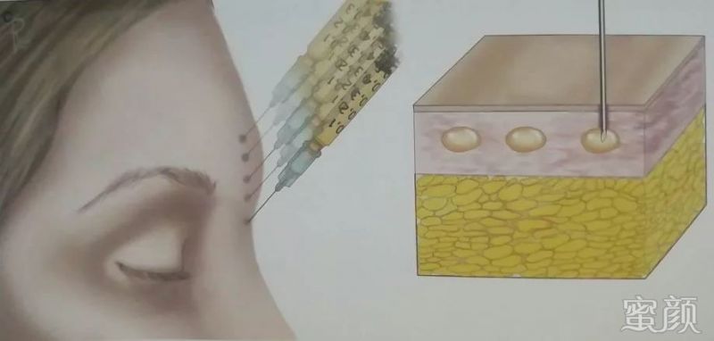 https://img.yiyiaimei.com/mnt/timg/200326/1241325X4-9.jpg