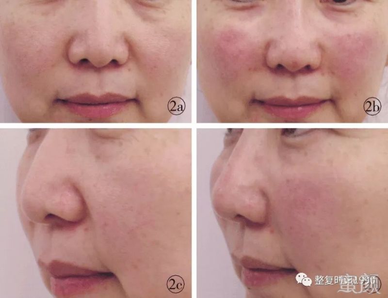 https://img.yiyiaimei.com/mnt/timg/200326/1241543200-1.jpg