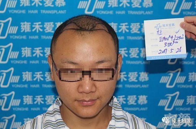 https://img.yiyiaimei.com/mnt/timg/200326/124GVH2-0.jpg
