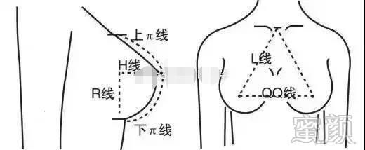 案例图片