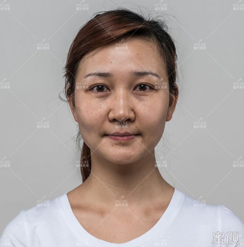 https://img.yiyiaimei.com/mnt/timg/200326/1254333564-10.jpg