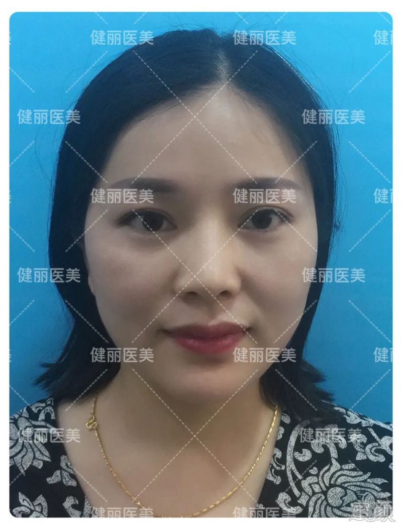 案例图片