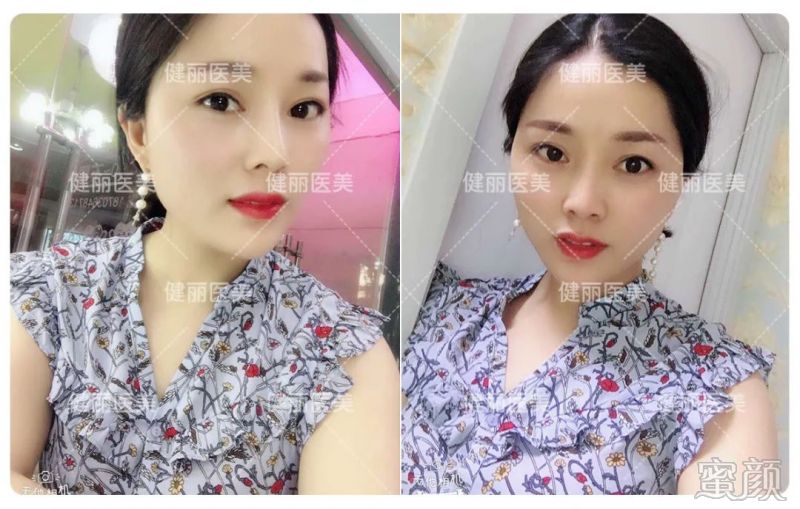 案例图片