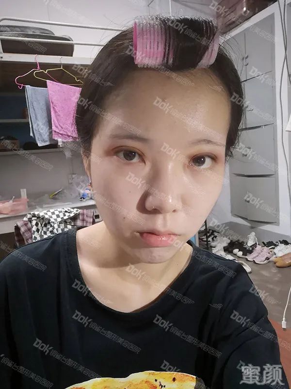 案例图片