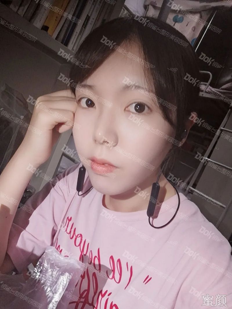 案例图片