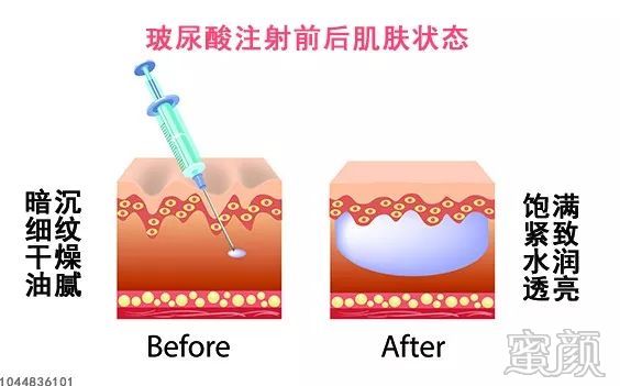 案例图片