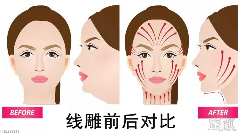 案例图片
