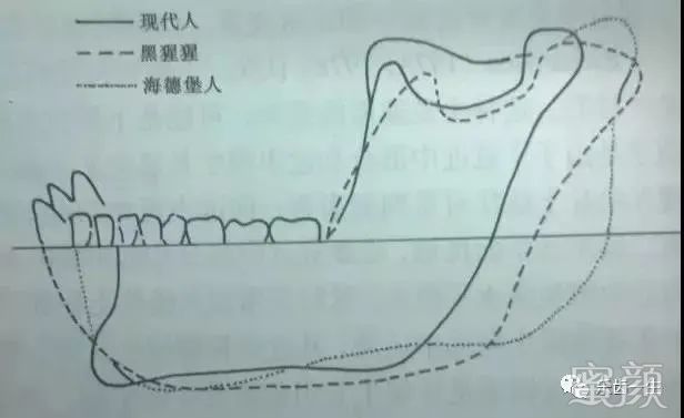 案例图片