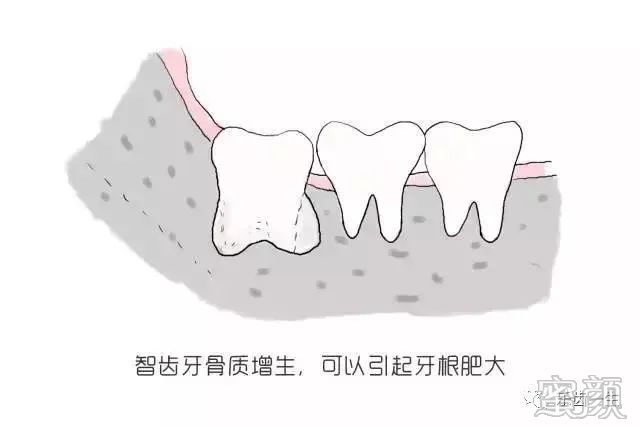 案例图片