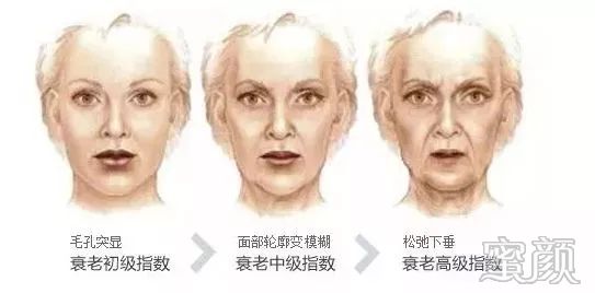 https://img.yiyiaimei.com/mnt/timg/200326/13100912F-0.jpg