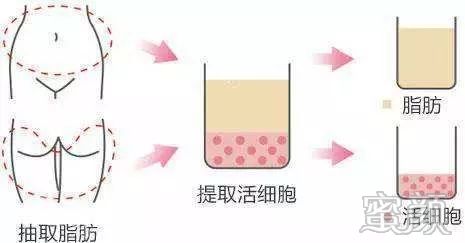 https://img.yiyiaimei.com/mnt/timg/200326/1310101a4-3.jpg