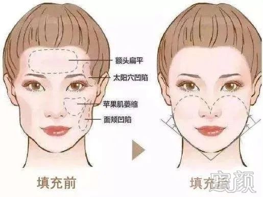 https://img.yiyiaimei.com/mnt/timg/200326/1310103W8-4.jpg