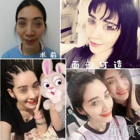 https://img.yiyiaimei.com/mnt/timg/200326/13101110T-7.jpg