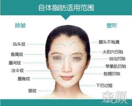 https://img.yiyiaimei.com/mnt/timg/200326/1310113648-5.jpg