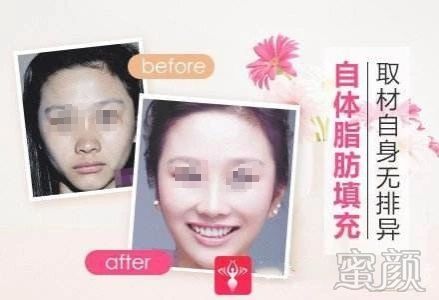https://img.yiyiaimei.com/mnt/timg/200326/1310116153-6.jpg