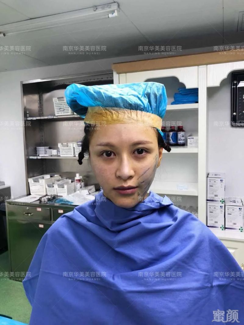 案例图片