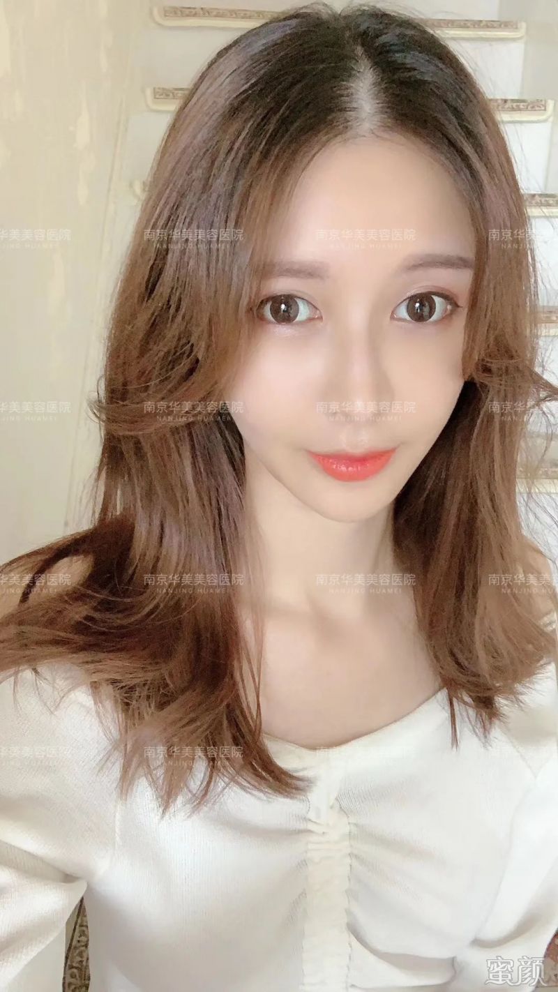 案例图片