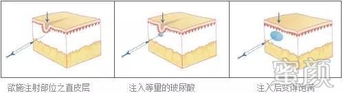 案例图片