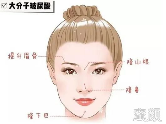 https://img.yiyiaimei.com/mnt/timg/200326/141000F39-6.jpg 案例图片