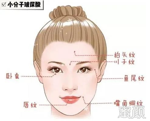 https://img.yiyiaimei.com/mnt/timg/200326/1410013Z0-7.jpg 案例图片