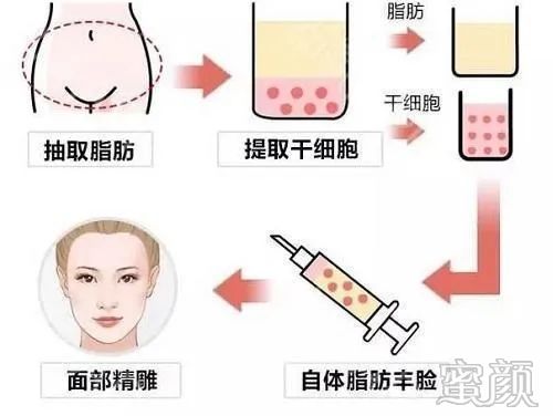 https://img.yiyiaimei.com/mnt/timg/200326/1J51360B-3.jpg