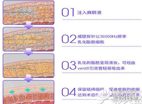 https://img.yiyiaimei.com/mnt/timg/200326/1K3034541-1.jpg