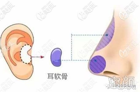 案例图片