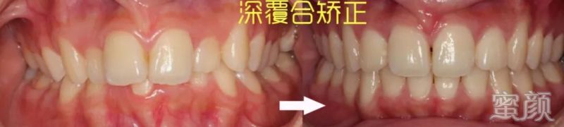 案例图片