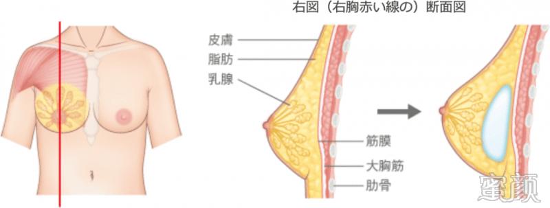 案例图片