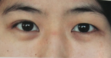 https://img.yiyiaimei.com/mnt/timg/200327/151A1L60-8.jpg