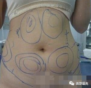 案例图片