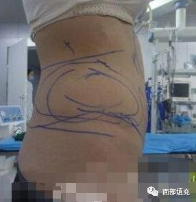 案例图片