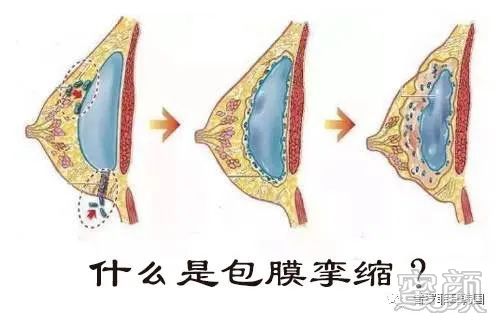 案例图片