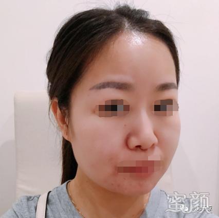 案例图片