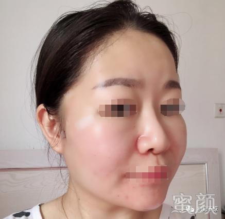 案例图片