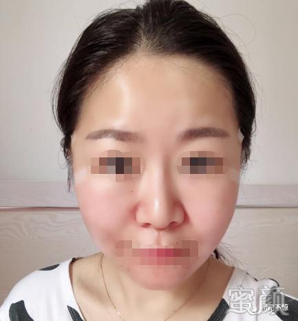 案例图片