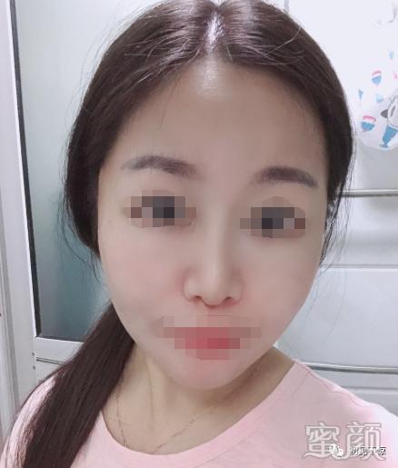 案例图片